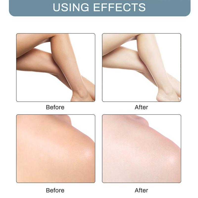 Achselaufhellungscreme