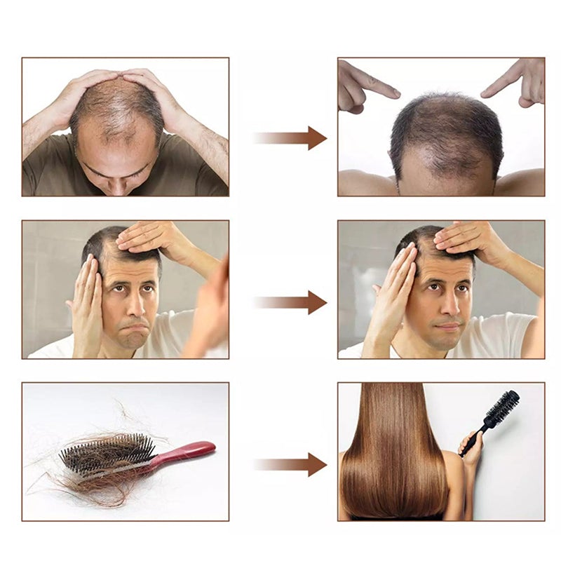 Haarpflegespray gegen Haarausfall